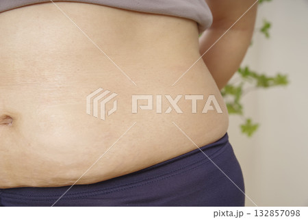 中年女性のぽっこりお腹と皮下脂肪 132857098