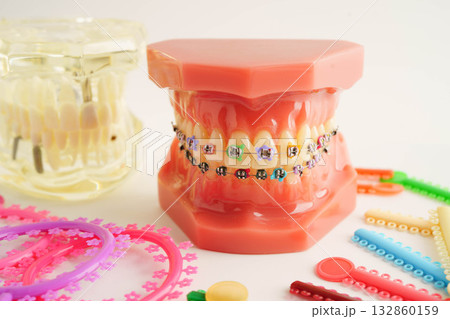 Orthodontic ligatures rings and ties, elastic rubber bands on orthodontic braces, model for dentist studying about dentistry. 132860159
