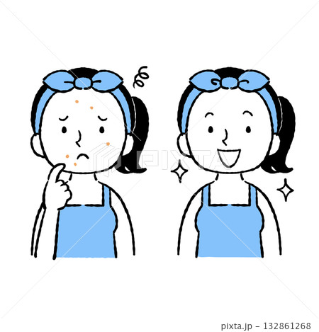 ニキビ改善 ニキビ改善 132861268