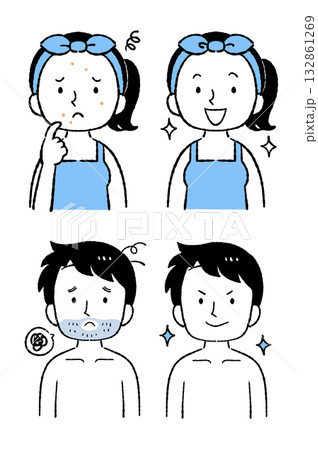 ニキビ改善、ひげ脱毛 132861269