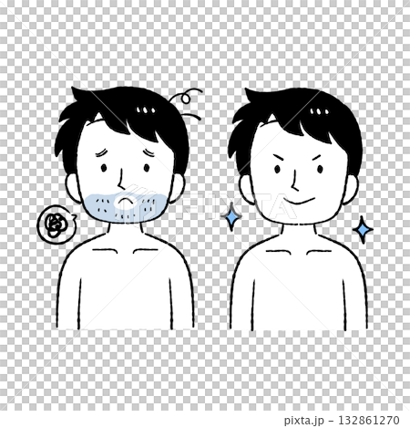 Beard hair removal 132861270