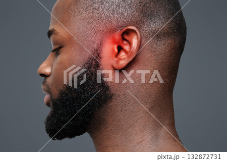 Side view of afro man with inflamed ear, close up 132872731