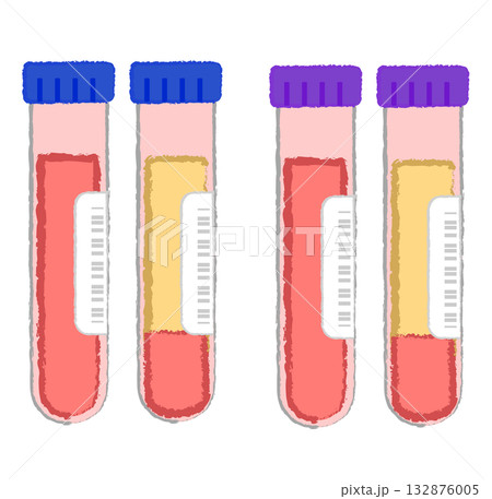 血液検査・血液サンプルが入った試験管 132876005