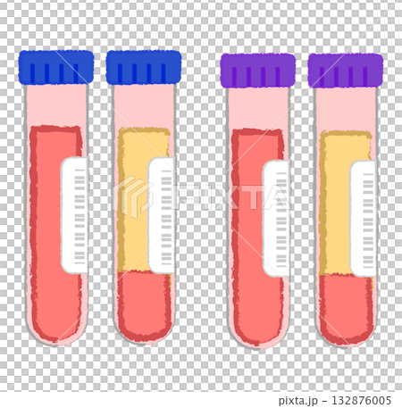 血液検査・血液サンプルが入った試験管 132876005