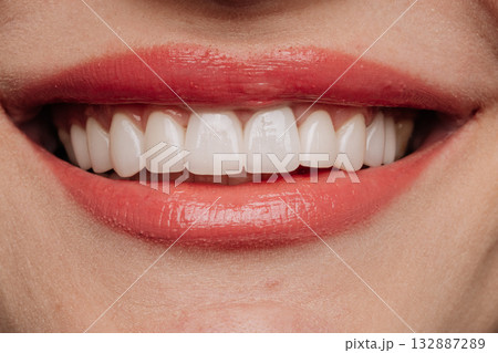 Closeup smile with white porcelain veneers and coral lipstick dental aesthetic beauty Closeup smile with white porcelain veneers and coral lipstick dental aesthetic beauty 132887289