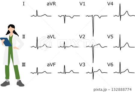 心電図を判読するグラフィック素材イラスト 132888774