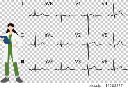 心電図を判読するグラフィック素材イラスト 132888774