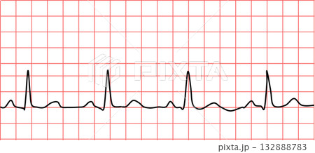 心電図のグラフィック素材イラスト 心電図のグラフィック素材イラスト 132888783