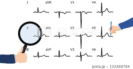 心電図を判読するグラフィック素材イラスト 132888784