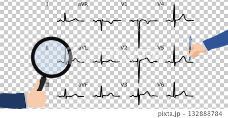 心電図を判読するグラフィック素材イラスト 132888784