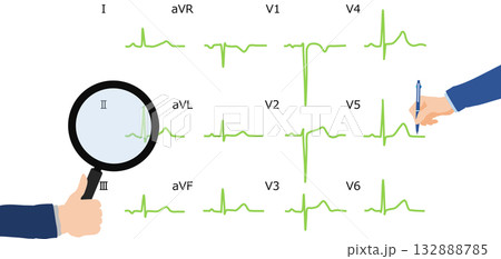 心電図を判読するグラフィック素材イラスト 132888785