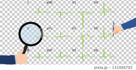 心電図を判読するグラフィック素材イラスト 132888785