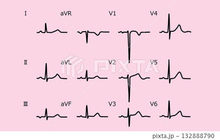心電図のグラフィック素材イラスト	 132888790