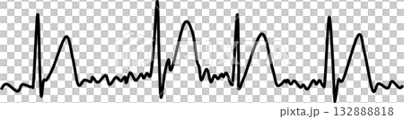 Atrial fibrillation graphic material illustration 132888818