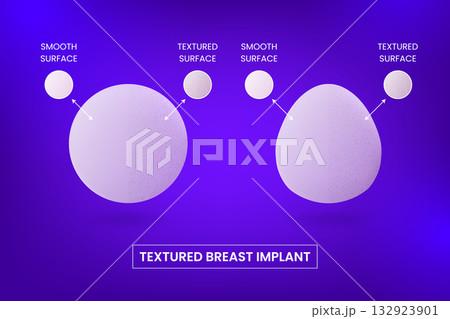 Different types and textured surfaces of silicone breast implants, round and teardrop shapes, vector plastic surgery 132923901