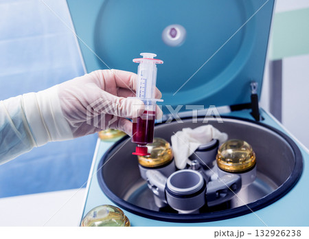 Platelet-Rich plasma preparation. Plasma in syringe. Centrifuge. 132926238