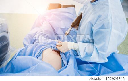 Arthroscope surgery. Orthopedic surgeons in teamwork in the operating room 132926243