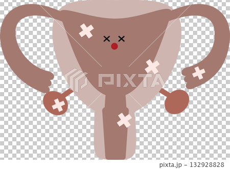 患病子宮的插圖 132928828