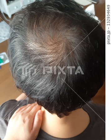 男性の頭頂部　頭部　ケア 132934649