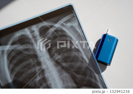 Electronic cigarette and lung x-ray. Tobacco heating system. Electronic cigarette and lung x-ray. Tobacco heating system. 132941238