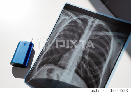 Electronic cigarette and lung x-ray. Tobacco heating system.  132941528