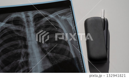Electronic cigarette and lung x-ray. Tobacco heating system.  132941821