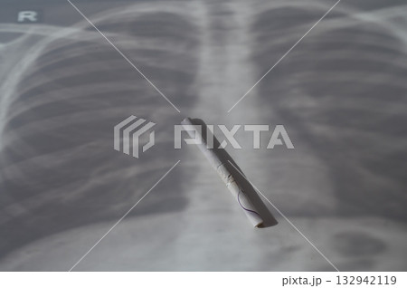 A cigarette lies on an x-ray of the lungs. A cigarette lies on an x-ray of the lungs. 132942119