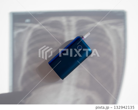 Electronic cigarette and lung x-ray. Tobacco heating system.  132942135