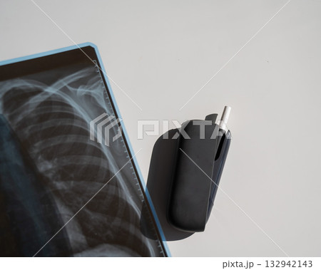 Electronic cigarette and lung x-ray. Tobacco heating system. Electronic cigarette and lung x-ray. Tobacco heating system. 132942143