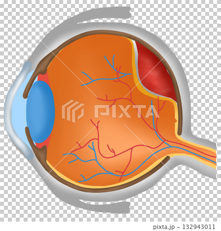 Ocular Tumor or Eye Cancer, Malignant Growth in Eye Anatomy 132943011