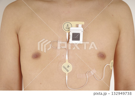 心電図ホルターを装着した中年男性の胸部 132949738