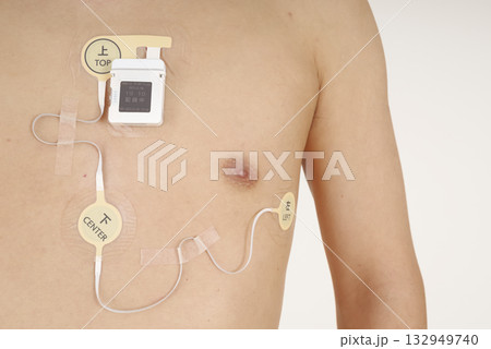 心電図ホルターを装着した中年男性の胸部 132949740