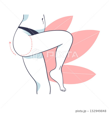 Plastic Surgery with Thigh Body Part Correction in Aesthetic Beauty Clinic Vector Illustration 132949848
