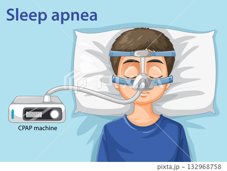 Child Using CPAP Machine for Sleep Apnea Treatment 132968758