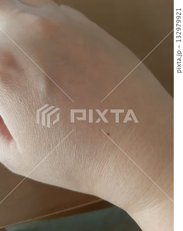 女性の手　手の甲のほくろ　手の甲 132979921