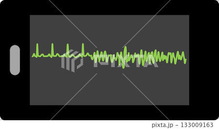 Electrocardiogram graphic material illustration Electrocardiogram graphic material illustration 133009163