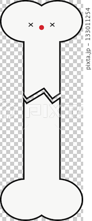 完全骨折のイラスト 完全骨折のイラスト 133011254