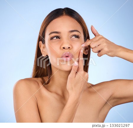 Skincare, squeeze pimple and woman with natural cosmetics, dermatology and girl against blue studio background. Female, lady and model with acne, pop blackhead and facial scar with expression on face 133021297