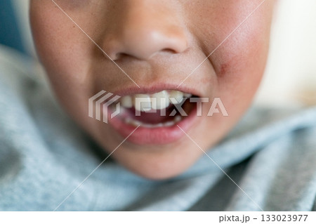 11 years old 11 years old 133023977