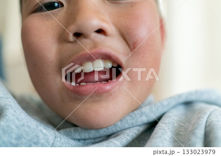 11 years old 11 years old 133023979