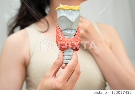 Hyperthyroidism, Overactive Thyroid, Thyroid Lymphoma, Asian woman with thyroid gland human anatomy model. Hyperthyroidism, Overactive Thyroid, Thyroid Lymphoma, Asian woman with thyroid gland human anatomy model. 133037459