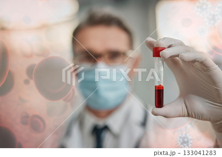 Covid, doctor and blood test overlay for medicine, healthcare and virus testing in laboratory. Science, analytics and dna for medical research and vaccine manufacturing, innovation in pathology lab. 133041283
