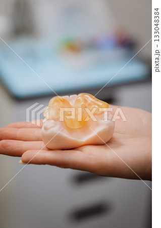 Transparent implant surgical guide on dental jaw model in clinician hand, clinic closeup Transparent implant surgical guide on dental jaw model in clinician hand, clinic closeup 133048384