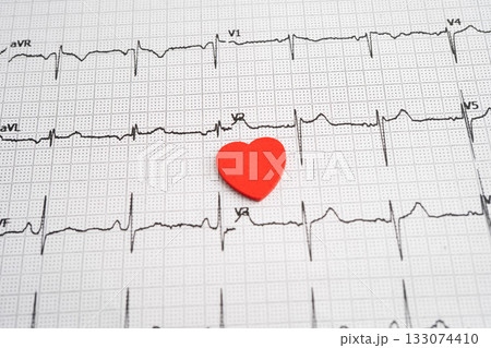 Electrocardiogram ECG heart wave, heart attack, cardiogram report. 133074410