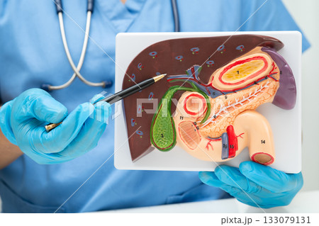 Liver with gallbladder, pancreas spleen and duodenum, Asian doctor holding human anatomy model for study diagnosis and treatment in hospital. Liver with gallbladder, pancreas spleen and duodenum, Asian doctor holding human anatomy model for study diagnosis and treatment in hospital. 133079131