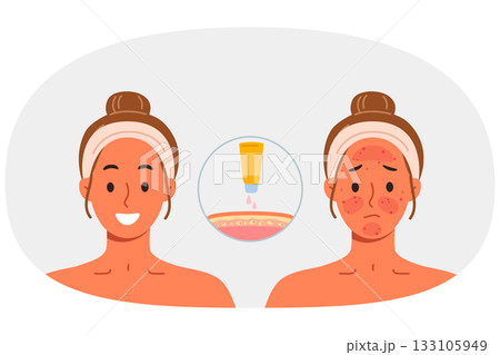 Sunscreen that protects skin from burns, next to girls demonstrating results before and after 133105949