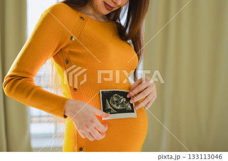 Prenatal ultrasound screening. Pregnant woman hands holding sonogram picture of unborn baby inside big belly. Happy expectant mom with fetus usi scan image. Young mother enjoying pregnancy. Maternity 133113046