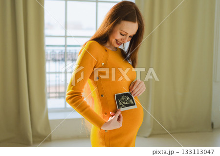 Prenatal ultrasound screening. Pregnant woman holding sonogram picture of unborn baby inside her big belly. Happy expectant mom with fetus usi scan image. Young mother enjoying pregnancy. Maternity 133113047