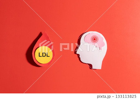 High LDL cholesterol increases the risk of stroke by boosting the risk of vascular disease. LDL cholesterol particles inside a blood droplet and human brain made from paper on red background. 133113825