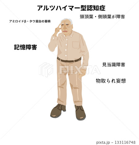 アルツハイマー型認知症の特徴を示す高齢者の全身医療イラスト|記憶障害・見当識障害・アミロイドβ蓄積 アルツハイマー型認知症の特徴を示す高齢者の全身医療イラスト|記憶障害・見当識障害・アミロイドβ蓄積 133116748
